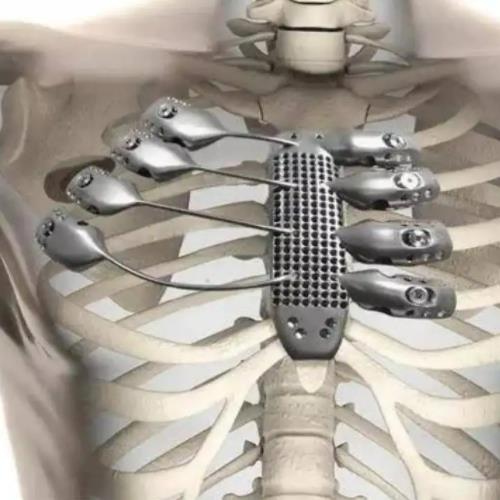 煙臺鈦合金用于醫療